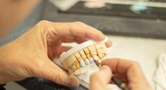 Kiedy stosowane są miniimplanty ortodontyczne?